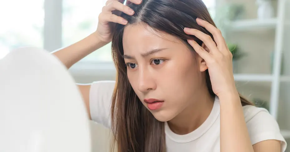 Akar Rambut Mulai Melemah