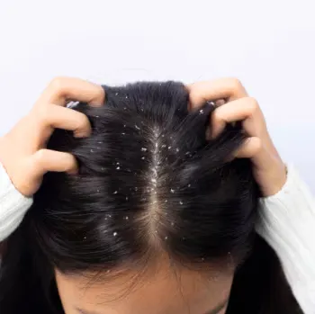 ketombe-sunsilk