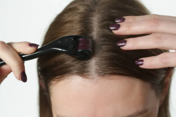 tips mengatasi rambut menipis