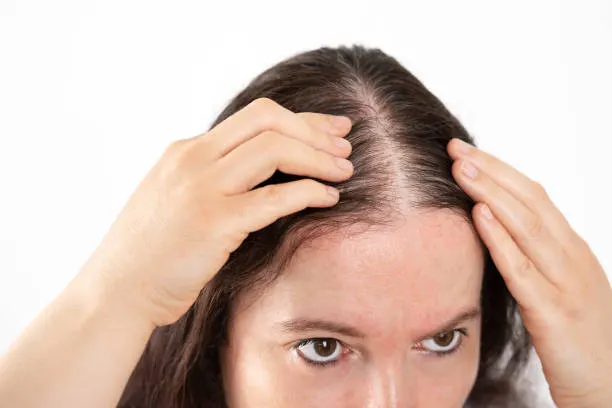 close up of woman controls hair loss