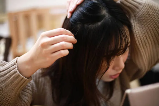 rambut hampir botak