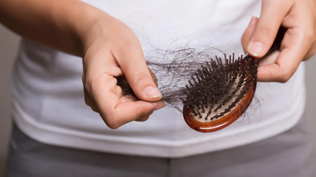 rambut rontok