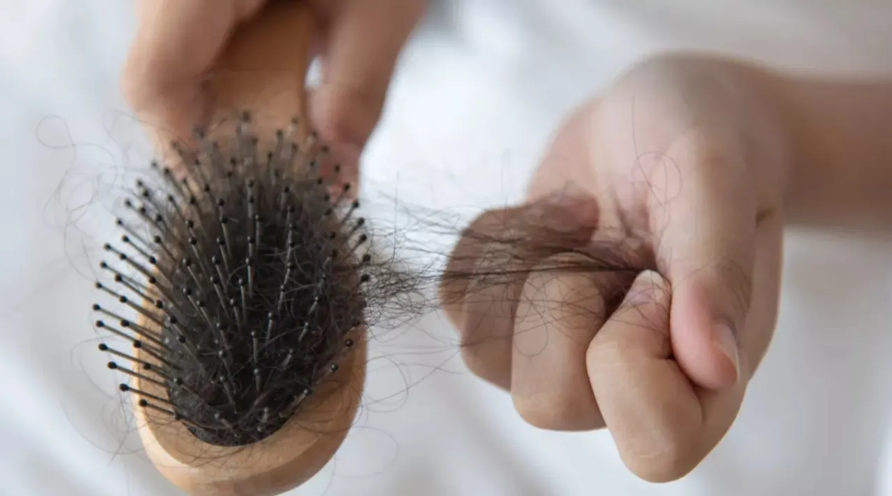 Mengapa Rambut Rontok Saat Musim Gugur? Ini Penjelasannya