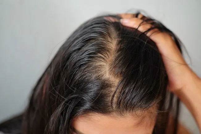 Cara Alami Mengatasi Penipisan Rambut Secara Efektif