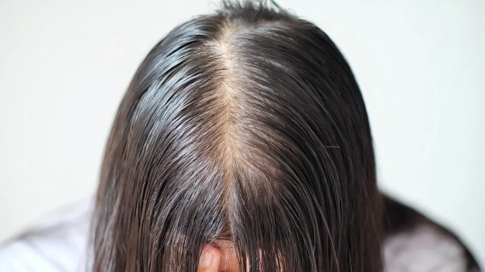 Penipisan Rambut: Kapan Harus Khawatir dan Mengunjungi Dokter?