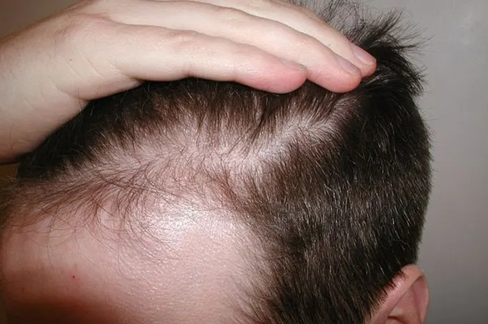 Cara Mencegah Uban Dini dan Menjaga Kesehatan Rambut