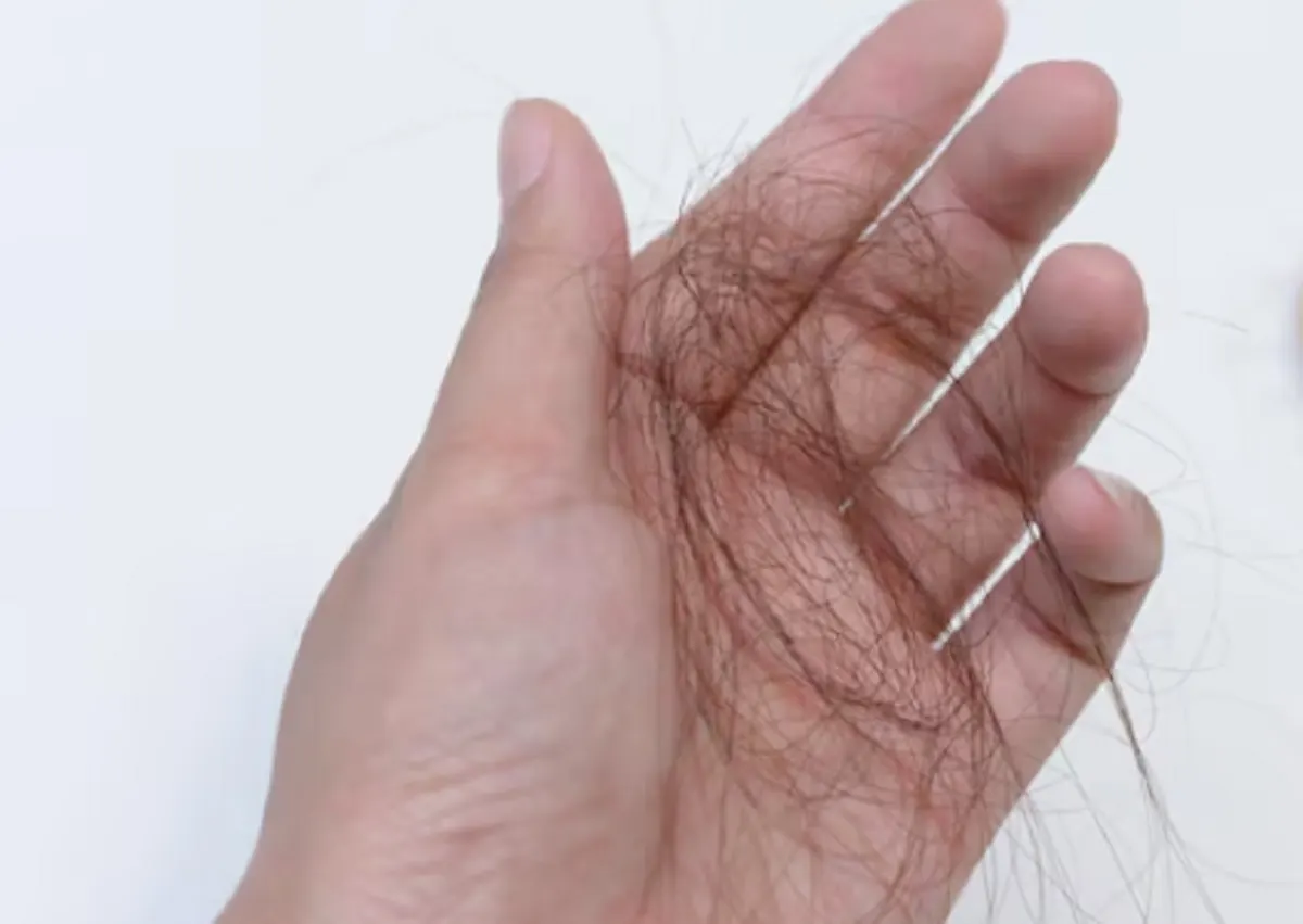 Minyak Kelapa vs Minyak Jarak: Mana yang Lebih Jago Lawan Rambut Rontok?