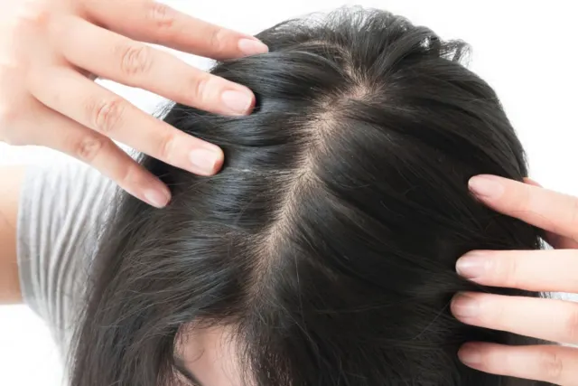Penyebab Penipisan Rambut: Faktor Internal dan Eksternal yang Perlu Diketahui