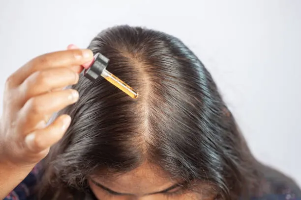Rambut Sehat Dimulai dari Kulit Kepala: Ritual Perawatan untuk Mengontrol Ketombe Jangka Panjang