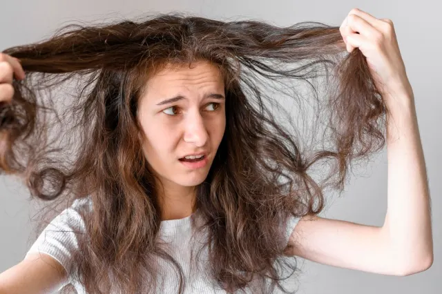 Ketombe dan Rambut Rontok: Apa Hubungannya?