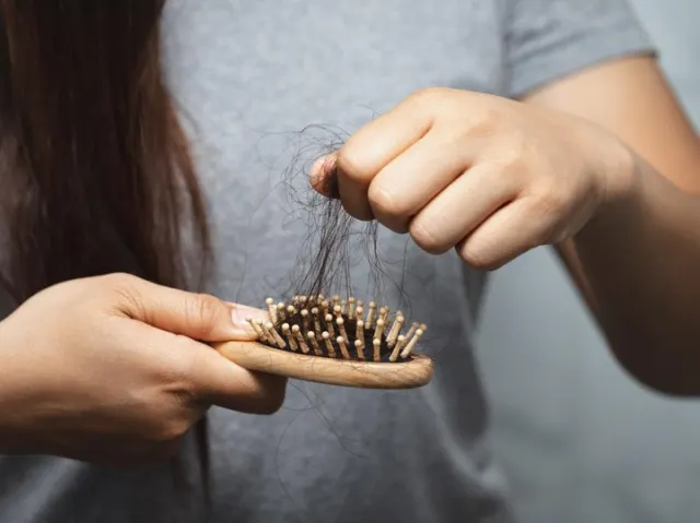 Vitamin Rambut Terbaik: Solusi Alami untuk Atasi Rambut Rontok dengan Ampuh