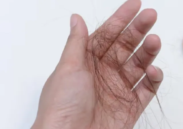 10 Tips Ampuh Mencegah Rambut Rontok Sejak Dini (Santai Tapi Efektif!)