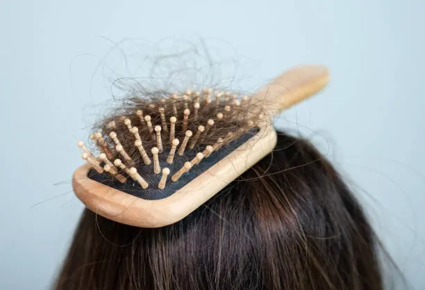 Pengaruh Hormon terhadap Kesehatan Rambut: Penyebab, Gejala, dan Cara Mengatasinya